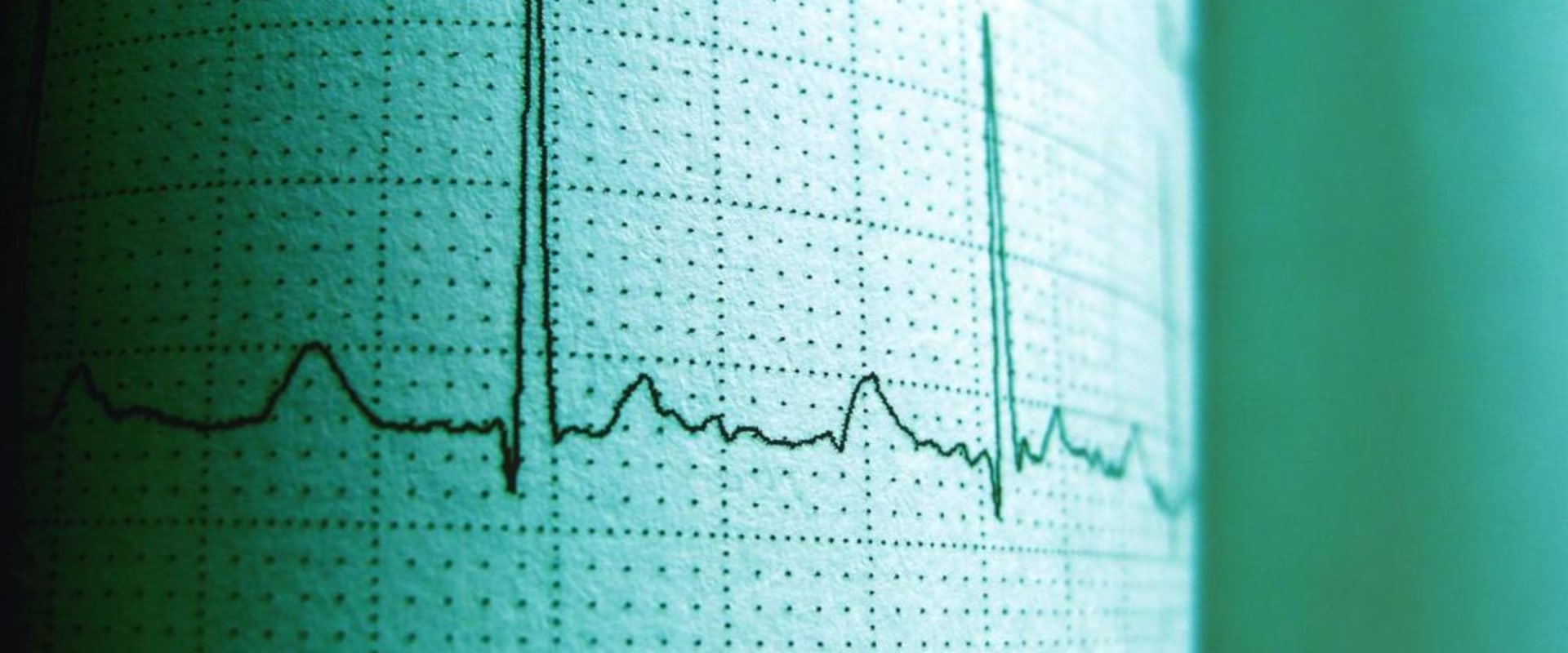 Marginal Cost-Benefit Analysis for Expenditure Analysis