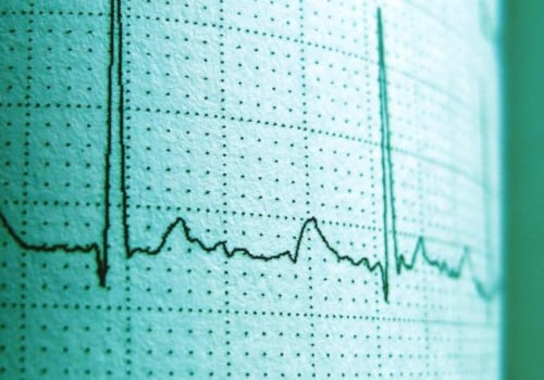 Marginal Cost-Benefit Analysis for Expenditure Analysis